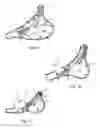 Fig. 02 - TISSUE-ACQUISITION AND FASTENING DEVICES AND METHODS