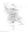 Fig. 45 - EXTERNAL FIXATION SYSTEM