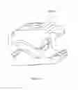 Fig. 71 - EXTERNAL FIXATION SYSTEM