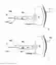 Fig. 06 - Methods for renal neuromodulation via catheters having expandable treatment members