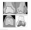 Fig. 01 - METHOD FOR PLANNING A SURGICAL INTERVENTION