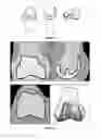 Fig. 02 - METHOD FOR PLANNING A SURGICAL INTERVENTION