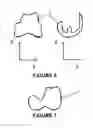Fig. 04 - METHOD FOR PLANNING A SURGICAL INTERVENTION