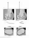 Fig. 05 - METHOD FOR PLANNING A SURGICAL INTERVENTION