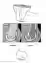 Fig. 06 - METHOD FOR PLANNING A SURGICAL INTERVENTION