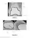Fig. 07 - METHOD FOR PLANNING A SURGICAL INTERVENTION