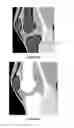 Fig. 08 - METHOD FOR PLANNING A SURGICAL INTERVENTION