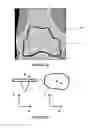 Fig. 10 - METHOD FOR PLANNING A SURGICAL INTERVENTION