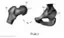Fig. 07 - Patient-Specific Surgical Guidance Tool and Method of Use