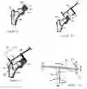 Fig. 09 - Patient-Specific Surgical Guidance Tool and Method of Use