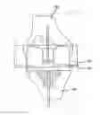 Fig. 01 - Preoperatively planning an arthroplasty procedure and generating a corresponding patient specific arthroplasty resection guide