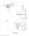 Fig. 02 - Preoperatively planning an arthroplasty procedure and generating a corresponding patient specific arthroplasty resection guide