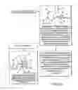 Fig. 06 - Preoperatively planning an arthroplasty procedure and generating a corresponding patient specific arthroplasty resection guide