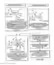 Fig. 07 - Preoperatively planning an arthroplasty procedure and generating a corresponding patient specific arthroplasty resection guide
