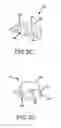 Fig. 09 - Preoperatively planning an arthroplasty procedure and generating a corresponding patient specific arthroplasty resection guide