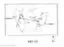 Fig. 28 - Preoperatively planning an arthroplasty procedure and generating a corresponding patient specific arthroplasty resection guide