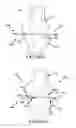 Fig. 33 - Preoperatively planning an arthroplasty procedure and generating a corresponding patient specific arthroplasty resection guide