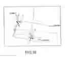 Fig. 35 - Preoperatively planning an arthroplasty procedure and generating a corresponding patient specific arthroplasty resection guide