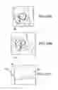 Fig. 40 - Preoperatively planning an arthroplasty procedure and generating a corresponding patient specific arthroplasty resection guide
