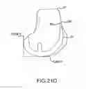 Fig. 47 - Preoperatively planning an arthroplasty procedure and generating a corresponding patient specific arthroplasty resection guide