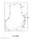 Fig. 48 - Preoperatively planning an arthroplasty procedure and generating a corresponding patient specific arthroplasty resection guide