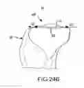 Fig. 52 - Preoperatively planning an arthroplasty procedure and generating a corresponding patient specific arthroplasty resection guide