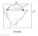 Fig. 53 - Preoperatively planning an arthroplasty procedure and generating a corresponding patient specific arthroplasty resection guide