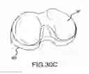 Fig. 65 - Preoperatively planning an arthroplasty procedure and generating a corresponding patient specific arthroplasty resection guide