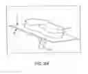 Fig. 67 - Preoperatively planning an arthroplasty procedure and generating a corresponding patient specific arthroplasty resection guide