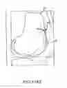Fig. 69 - Preoperatively planning an arthroplasty procedure and generating a corresponding patient specific arthroplasty resection guide