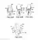 Fig. 71 - Preoperatively planning an arthroplasty procedure and generating a corresponding patient specific arthroplasty resection guide