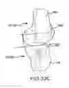Fig. 76 - Preoperatively planning an arthroplasty procedure and generating a corresponding patient specific arthroplasty resection guide