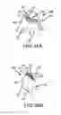 Fig. 77 - Preoperatively planning an arthroplasty procedure and generating a corresponding patient specific arthroplasty resection guide