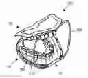 Fig. 01 - Methods, devices, systems, assemblies, and kits for tissue retraction in an oral cavity