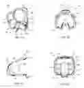 Fig. 06 - Methods, devices, systems, assemblies, and kits for tissue retraction in an oral cavity