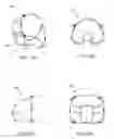 Fig. 22 - Methods, devices, systems, assemblies, and kits for tissue retraction in an oral cavity