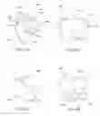 Fig. 35 - Methods, devices, systems, assemblies, and kits for tissue retraction in an oral cavity