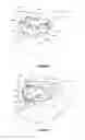 Fig. 02 - Dental framework and prosthesis