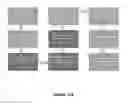Fig. 09 - Dental framework and prosthesis