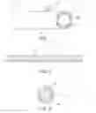 Fig. 02 - Composite prosthesis with external polymeric support structure and methods of manufacturing the same