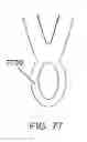 Fig. 44 - Abdominal aortic aneurysms: systems and methods of use