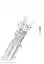 Fig. 52 - Abdominal aortic aneurysms: systems and methods of use