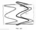Fig. 64 - Abdominal aortic aneurysms: systems and methods of use