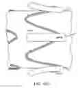 Fig. 65 - Abdominal aortic aneurysms: systems and methods of use