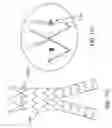 Fig. 72 - Abdominal aortic aneurysms: systems and methods of use