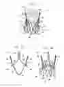 Fig. 02 - Sinus-engaging valve fixation member