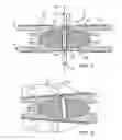 Fig. 02 - Intervertebral prosthetic disc