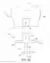 Fig. 08 - Long bone resurfacing bone lock