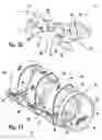 Fig. 09 - Splint and method of use