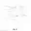 Fig. 06 - EXTERNAL ANKLE BRACE